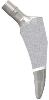 Maxx Orthopedics Expands Libertas® Hip Portfolio with the Introduction of the Keystone™ Hip System